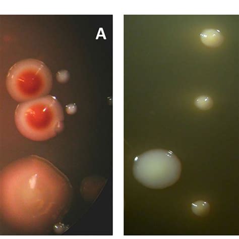 Figure Photomicrographs Of Subgingival Biofilm Samples From The