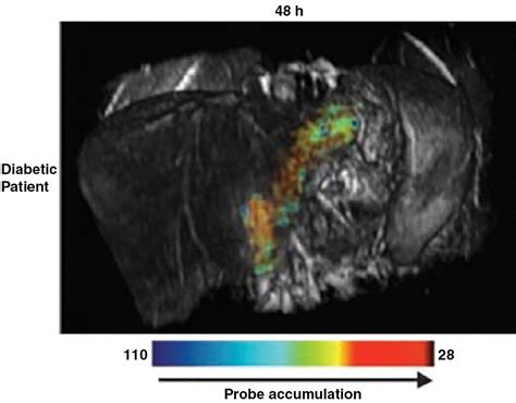 Iron Based Superparamagnetic Nanoparticle Contrast Agents For Mri Of