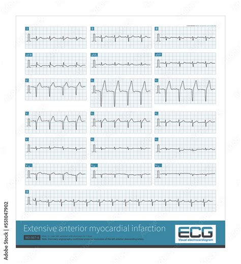 A Year Old Male Was Clinically Diagnosed As Extensive Anterior