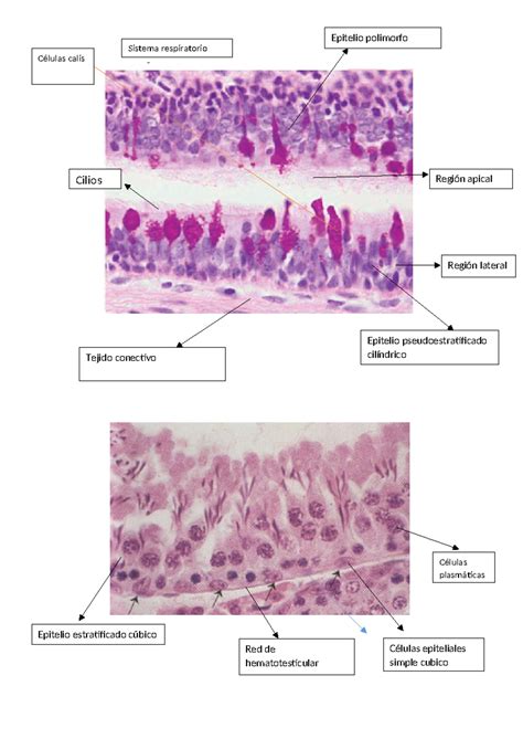 Tema 3 Histologia Trabajo Tarea Epitelio Pseudoestratificado Tejido Conectivo Cilíndrico