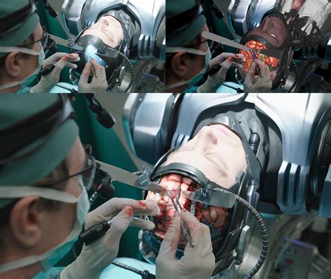 effects - How are surgery scenes shot in TV/Film? - Movies & TV Stack ...