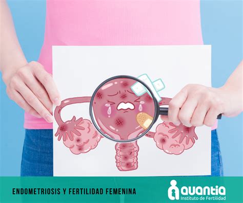 C Mo Afecta La Endometriosis A La Fertilidad Cl Nica De Fertilidad