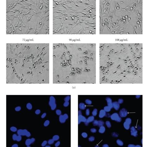 Annexin V Pi Double Staining Assay After Treating With Pk Cells Were