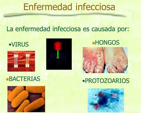 ENFERMEDADES INFECCIOSAS