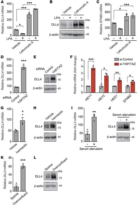 JCI Lysophosphatidic Acidinduced YAP TAZ Activation Promotes