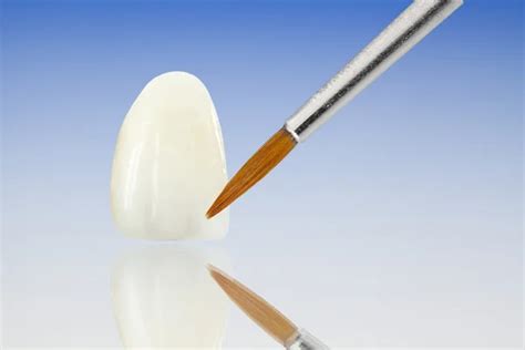 Metal Free Ceramic Dental Crowns Stock Photo Seb Ra