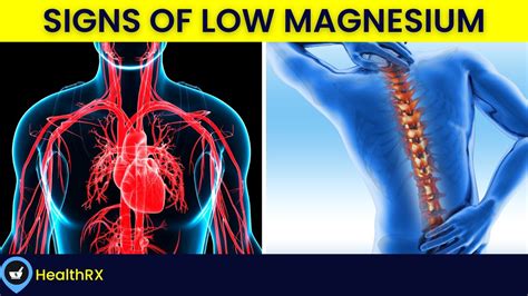 10 Signs Of Low Magnesium Symptoms Of Magnesium Deficiency Youtube