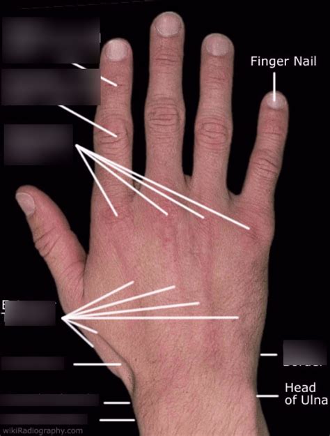 Landmarks Of Hand Diagram Quizlet