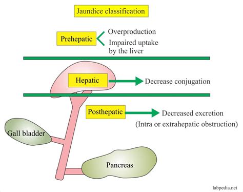 Liver Function Tests Part 3 Bilirubin Jaundice And Liver Function Test Lft