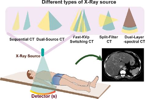 llustrates the different types of x-ray source available for the ...