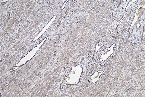 Neutrakine® Tgf Beta 1 Antibody 69012 1 Ig Proteintech