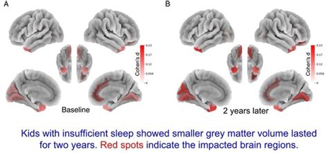 Children Who Lack Sleep May Experience Detrimental Impact on Brain and ...