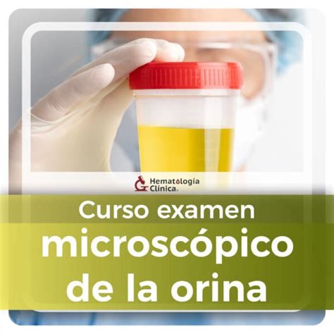 Examen Microsc Pico De La Orina Octubre Hematolog A Cl Nica