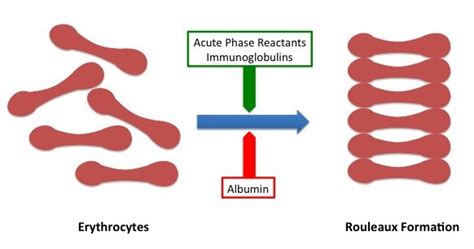 ESR erythrocyte sedimentation rate 은 무엇인가 Medical Programmer