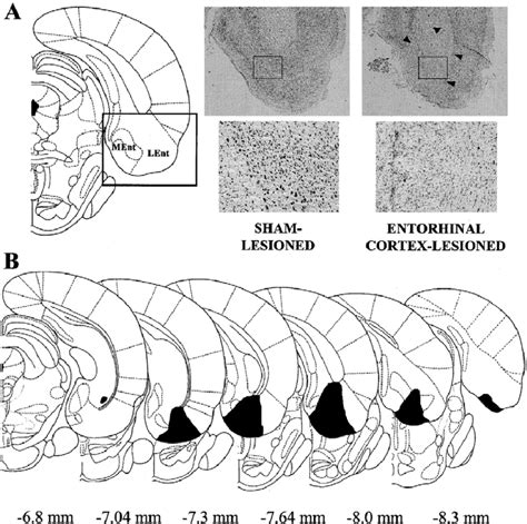 A Photomicrographs Of Cresyl Violet Stained Frontal Sections