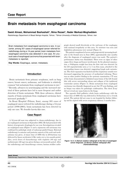 Pdf Case Report Brain Metastasis From Esophageal Carcinoma