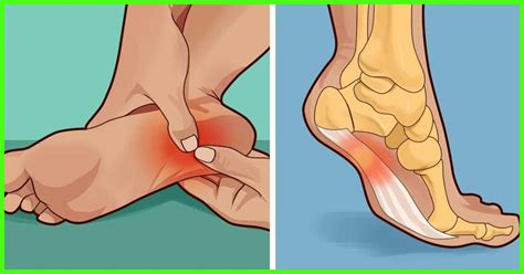 16 Home Remedies For Swollen Feet, Symptoms, And Treatments