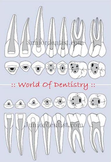 World Of Dentistry The Ideal Teeth Access Cavity Preparations