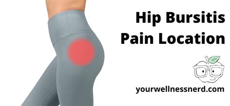 Hip Pain Location Chart Diagram