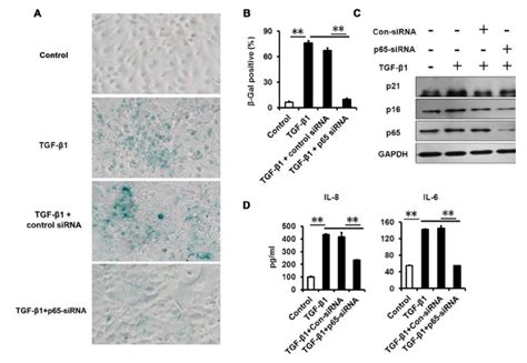 NF κB p65 konckdown attenuates TGF β1 induced senescence and SASP