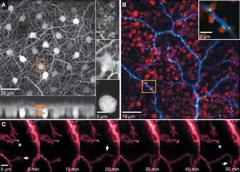 Three Examples Of Live Mouse Retinal Explant Imaging A Horizontal