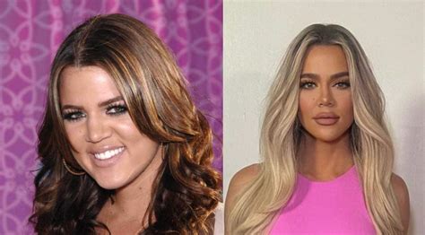 Khloe Kardashian Before And After: Her Amazing Transformation Stuns Everyone!