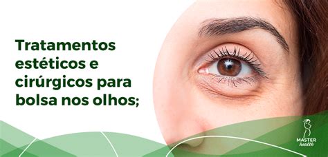 Bolsa Nos Olhos Descubra Agora Como Tratar Blog Master Health