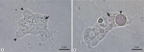 Figure 1 From A Fatal Case Of Naegleria Fowleri Meningoencephalitis In Taiwan Semantic Scholar