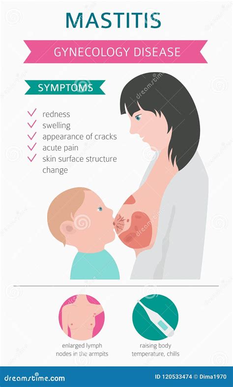 Mastitis Signs