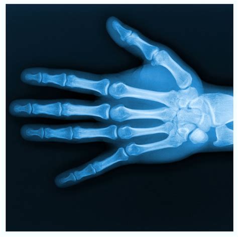 Pediatric Hand Surgery - Live Oak Surgery Center Plano