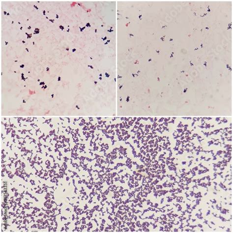 Gram Positive Cocci Under Microscope