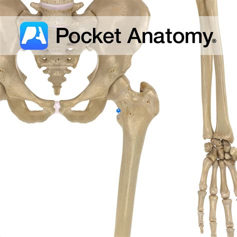 Femur - lesser trochanter - Pocket Anatomy