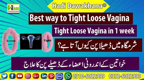 Vagina Tight Karny Ka Ilaj Loss Vagina Ka Ilaj Hadi Dawakh Flickr