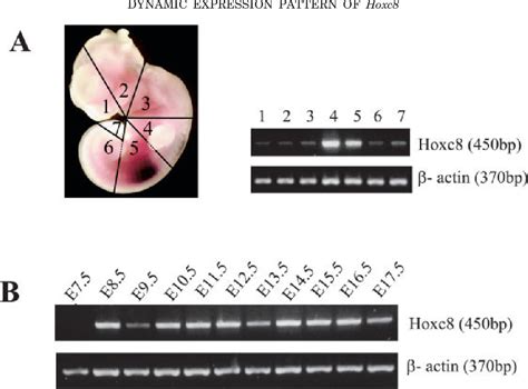 Figure From Dynamic Expression Pattern Of Hoxc During Mouse Early