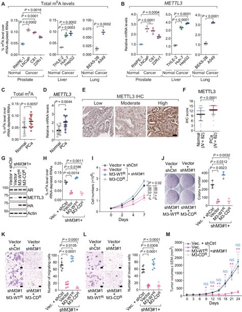 The M 6 A Methyltransferase METTL3 Is Up Regulated In Human Cancer And