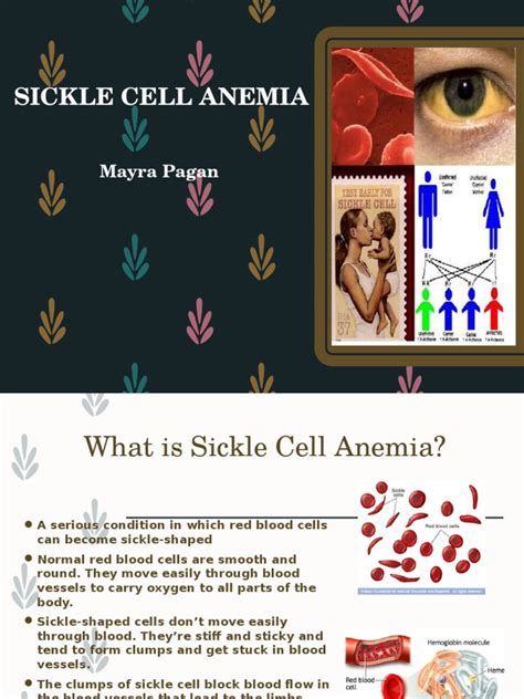 Understanding Sickle Cell Anemia Causes Symptoms Inheritance Patterns Treatments And