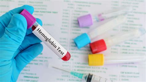 Hemoglobin test for results | Medasia.Store Anemia blog