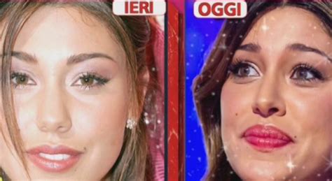 Belen Rifatta Le Foto Prima E Dopo La Chirurgia Estetica