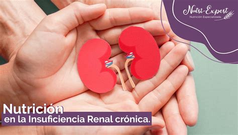 Nutrici N Renal En Toluca Expertos En Cuidado Renal