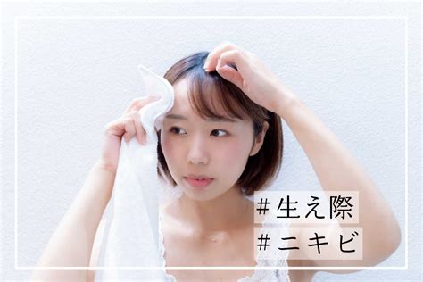 生え際にニキビができる原因と対処法｜肌とヘアケアの両方が大切 メディプラス乾燥予防研究所