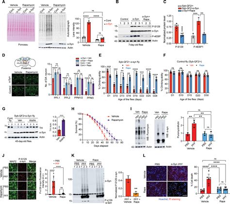 Enhanced mTORC1 signaling and protein synthesis in pathologic α