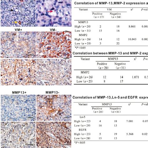 VM And The Expression Of MMP 13 MMP 2 Ln 5 And EGFR In LCLC Tissues