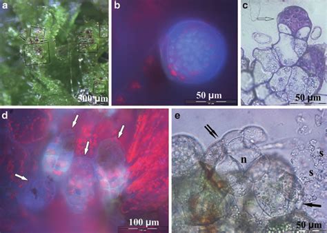 3 Sexual Organs Of Tree Fern Gametophytes Cultured In Vitro A A Few Download Scientific