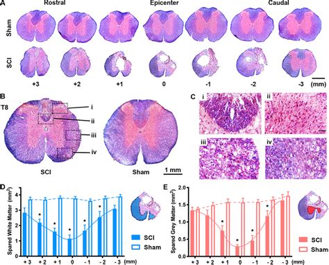 Histopathological Outcomes A Coronal Spinal Cord Sections In M