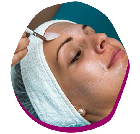 Chemical Peel Treatment Skin Brilliance