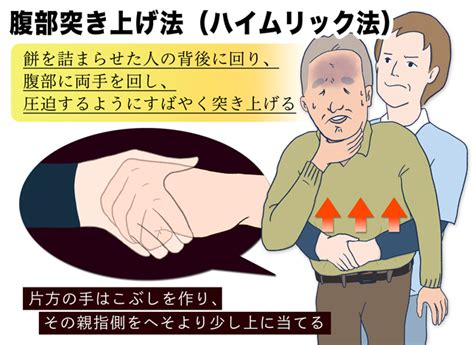 餅で死なないためのポイントもしもの時の「ハイムリック法」と「背部叩打法」とは ヨミドクター 読売新聞