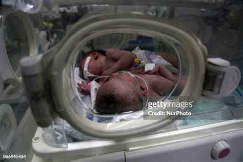 446 Twins Incubator Stock Photos, High-Res Pictures, and Images - Getty ...