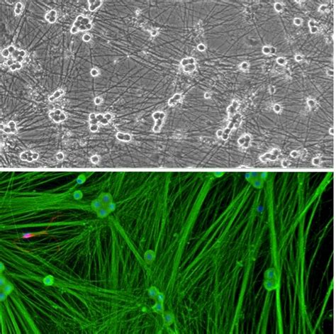 Rat Dorsal Root Ganglion Neurons Rdrgn Cell Model Expert Ipsc Primary