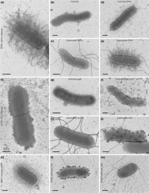 Assessment By Electron Microscopy Of Recombinant Vibrio Cholerae And