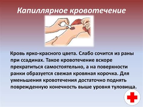 Виды кровотечений, их признаки. Первая помощь при кровотечениях ...